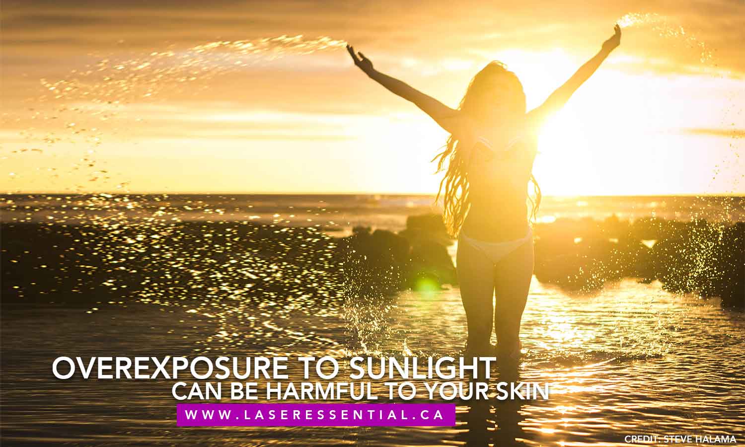 Overexposure to sunlight can be harmful to your skin